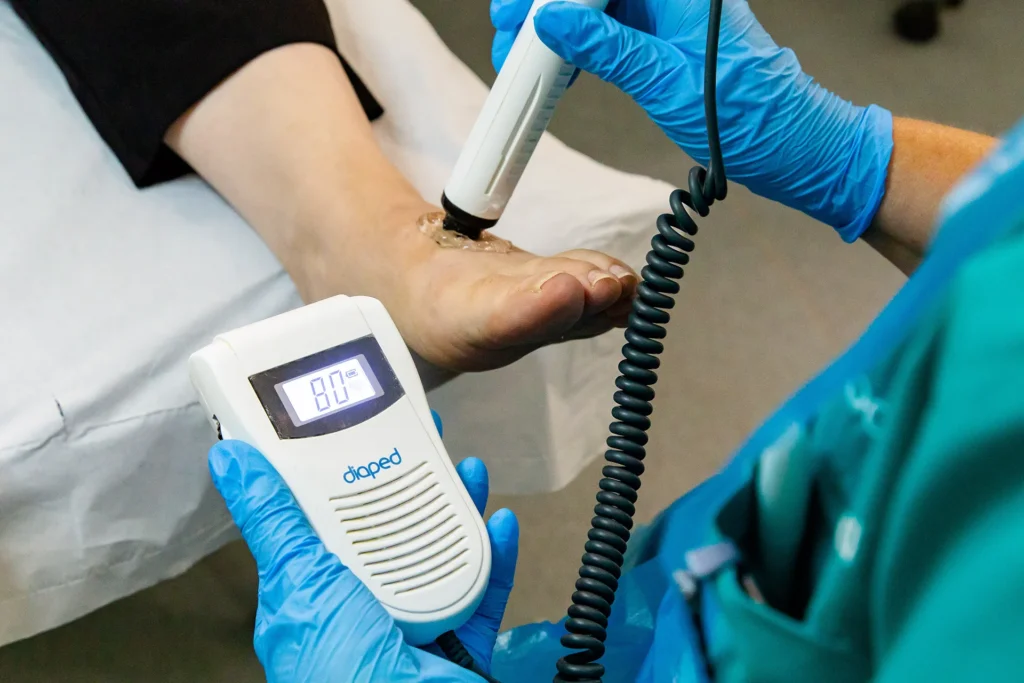 Doppler assessemt routine and Diabetic