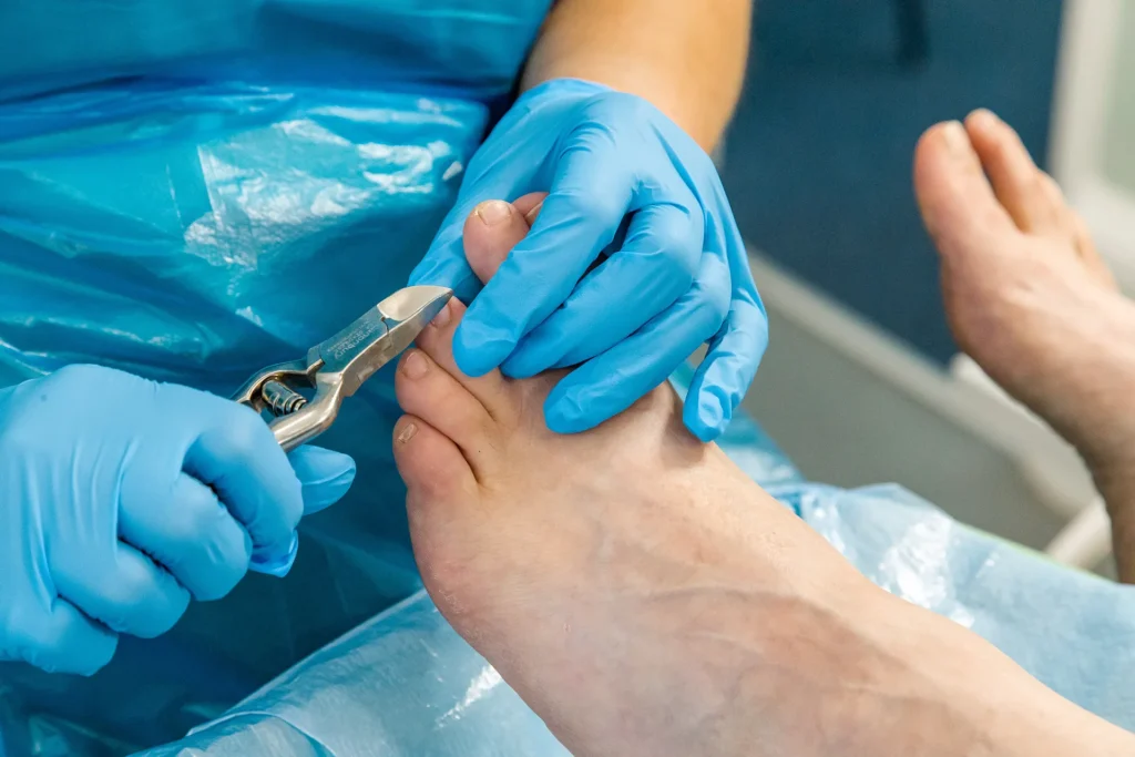 Nail cutting