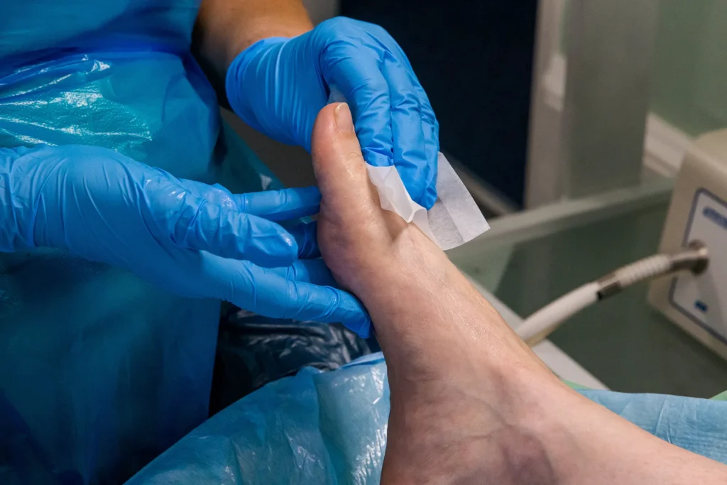 Treatment 3