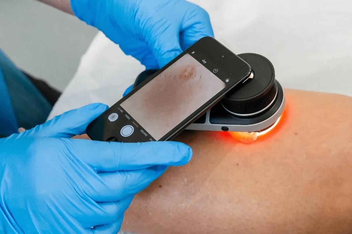 skin-cancer-awareness